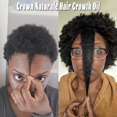 Forget Adibasi Hair Oil, Use Crown Naturale 10 N 1 Chebe Hair Growth Oil!