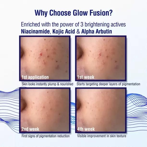 Say Goodbye to Dark Spots & Achieve Radiant, Even-Toned Skin with Our Advanced Kojic Acid Night Cream for All Skin Types (50 g