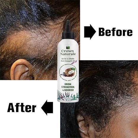 Forget Adibasi Hair Oil, Use Crown Naturale 10 N 1 Chebe Hair Growth Oil!